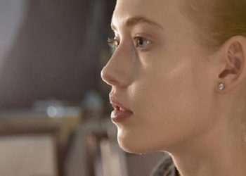 BURUN ESTETİĞİNDEN SONRA NELER OLUYOR?